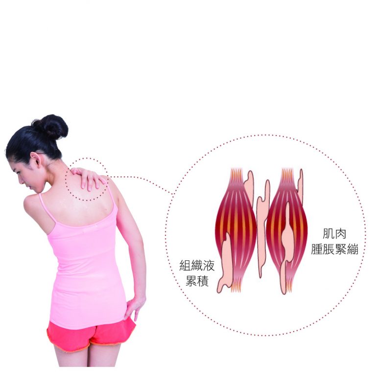 慢性痠痛的成因 慢性痠痛的成因